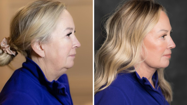 Image may contain Head Person Face Photography Portrait and Adult